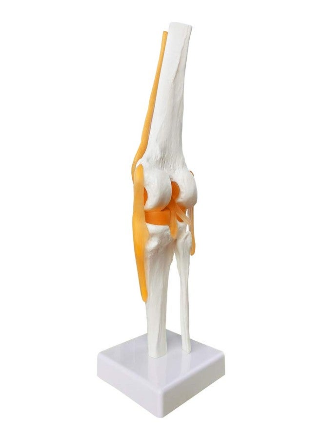 EVOTECH SCIENTIFIC Human Functional Knee Joint Model, with Ligament, Life Size for Medical Teaching Learning, Clinic Demonstration, Students Learning Education Display Tool - Image 3